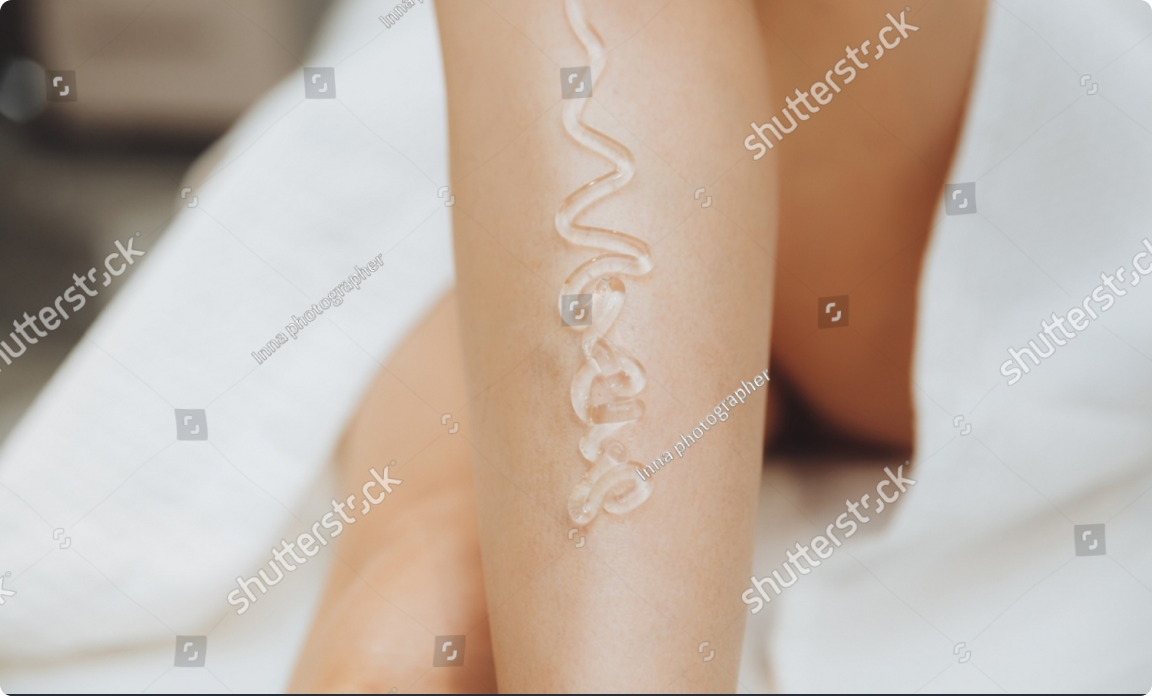 Лазеротерапія