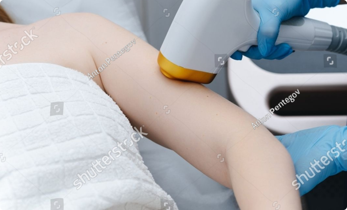 Вакуумний лазер