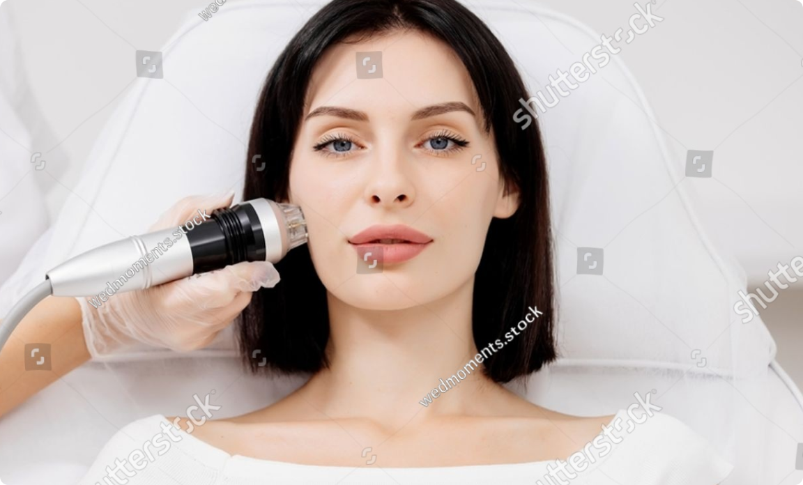 Мікроігольчатий RF ліфтинг